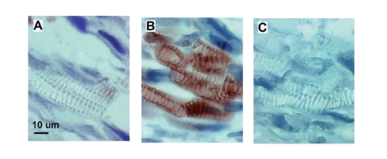 immunolocalization 